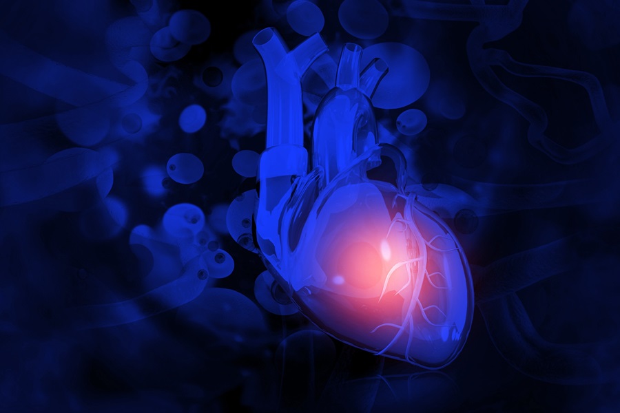 Image: AI yields promising results for advancing coronary angiography (Photo courtesy of 123RF)